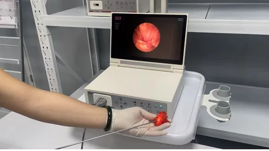 Semi Rigid Digital Ureteroscope Transureteroscopic Lithotripsy for Adult Electronic Ureteroscopic Ureterorenoscopy Endoscope 