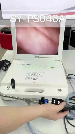 Fully HD Endoscope System Arthroscopy Endoscope Camera
