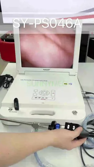 HD Endoscope Ent Arthroscopy Endoscope Camera 